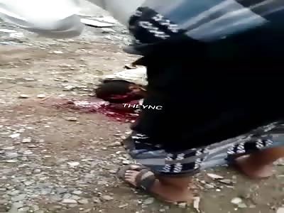 Man with a broken head