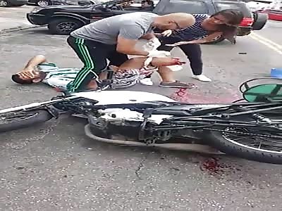 Ouch, someone lost their foot