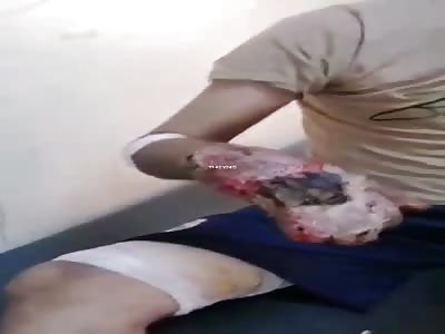 Man with hands made shit