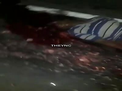 Head squashed like watermelon