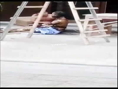 Burned in work accident