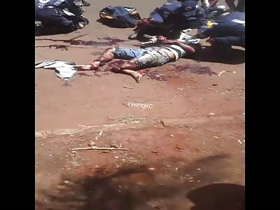 Victim of a serious accident