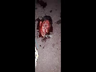 Head waiting to be kicked