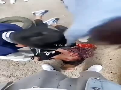 Young man receives brutal beating