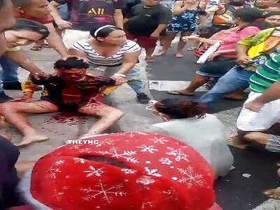 young man was shot several times