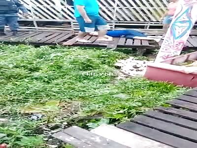 Young man shot in the head