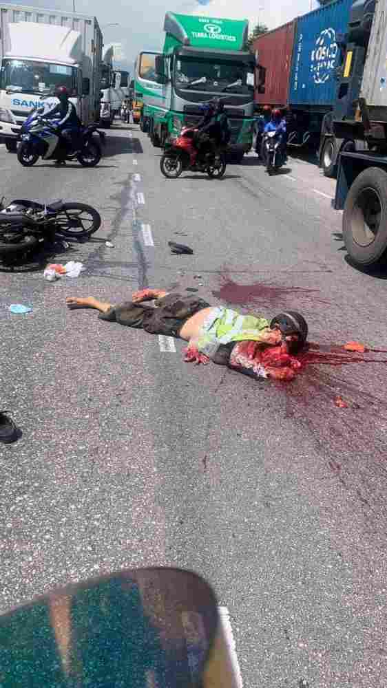 road accident victim
