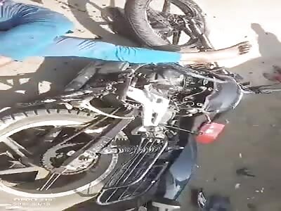 Consequence of motorcycle crash