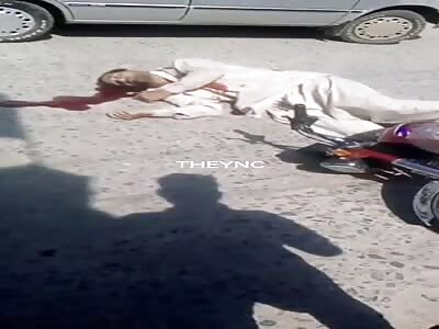 Man shot in the head