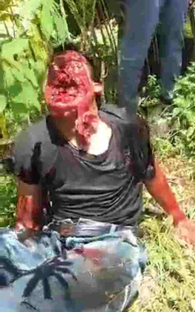 HORRIFYING: THE SOUNDS A DESTROYED FACE MAKES