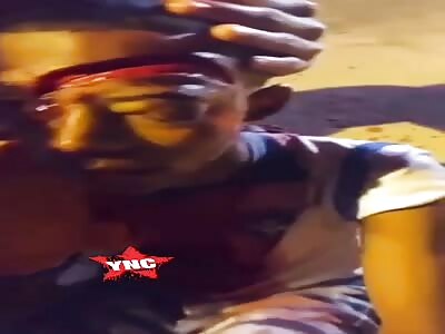 Young man with big cut on his face