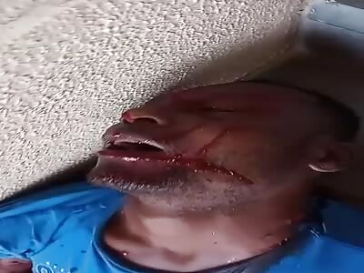 Dead man on the stairs