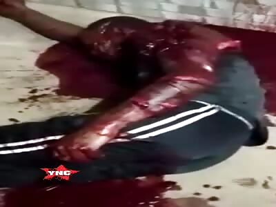 Man dying after being stung