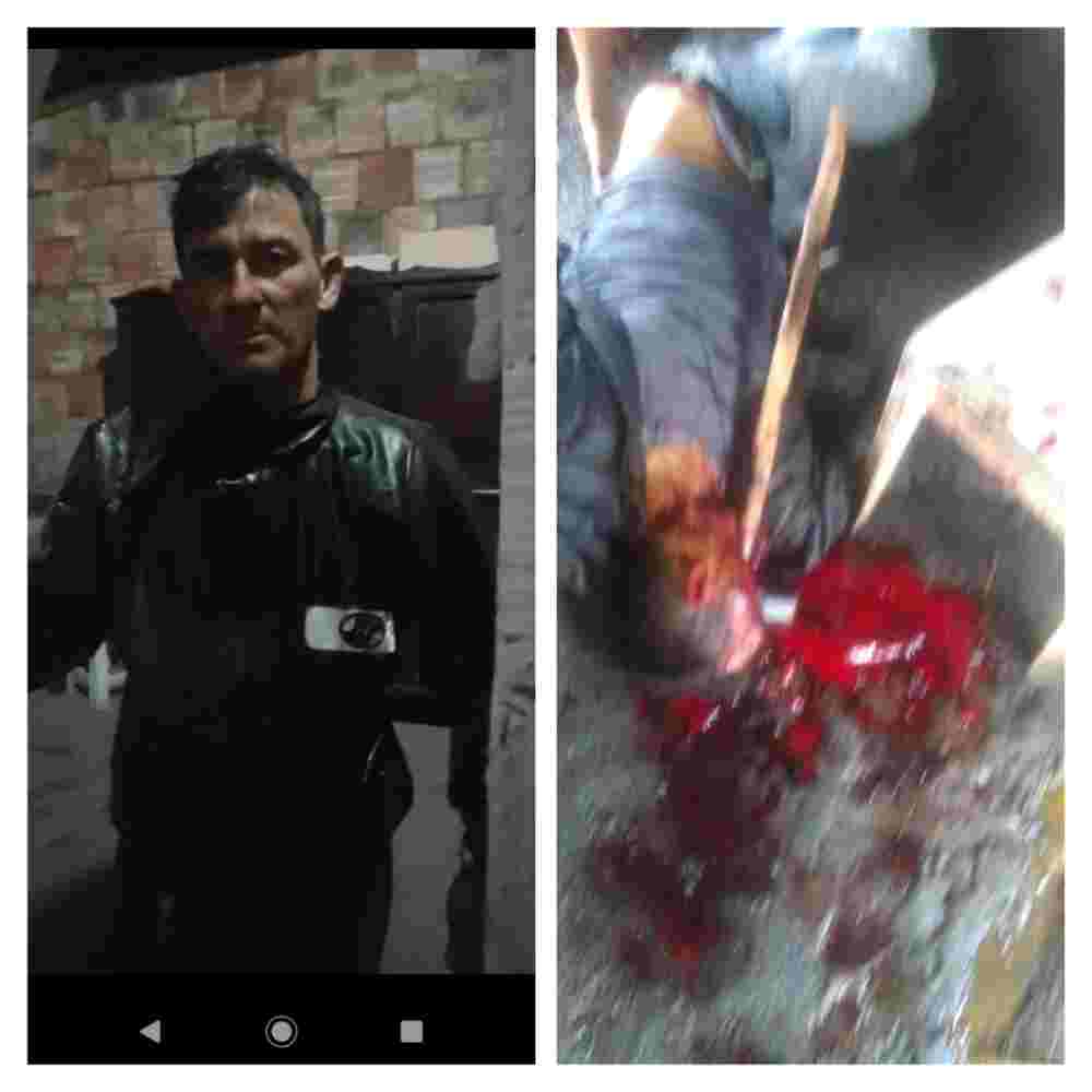 THE SLEDGEHAMMER WON!