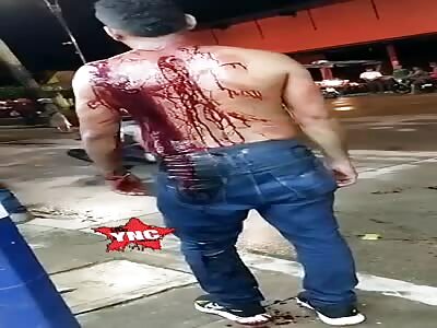 Man was stabbed with a bottle spout