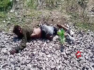 Finding of a corpse with amputated legs