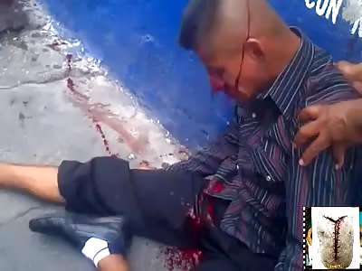 Wounded man in canteen