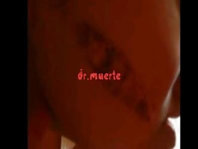 Girl burns her face by pyrotechnic game