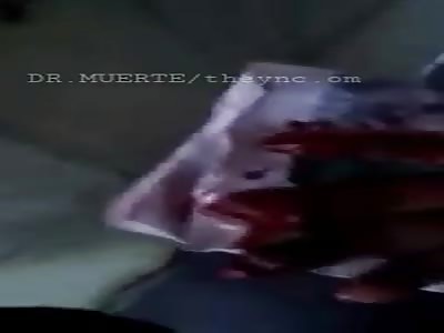 burns the hand with pyrotechnic game