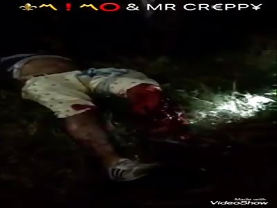 Loses his leg in motorcycle accident