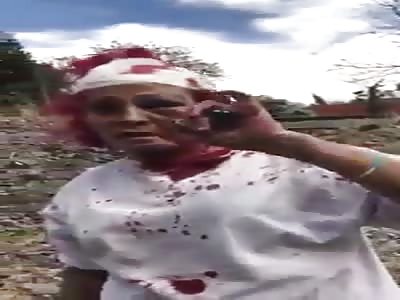 Drunk woman run over by the train