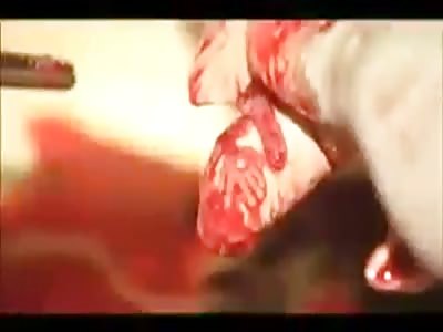 Abortions, not fit for sensitive! The moralists