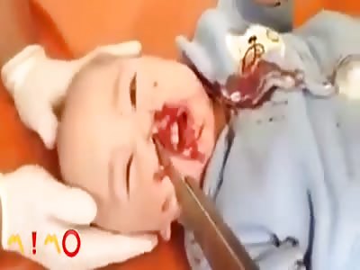 Boy with knife buried in the face