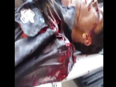 soldier syrian agonizing! the attack was for bombardment