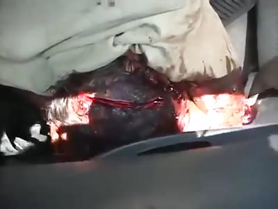 Man brutally attacked with machete