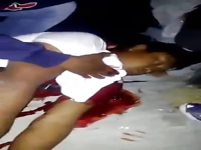 The man was attacked by police leaving him seriously injured