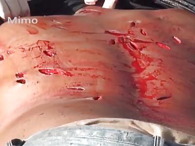 Man receives 40 stabs