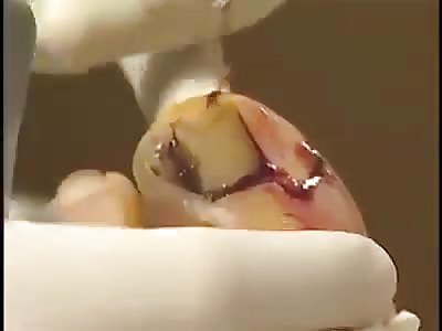 nail buried, my God that must have hurt