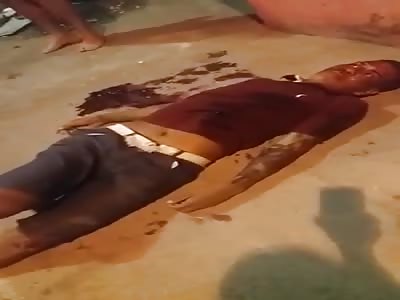 man shot! still alive fight for his life