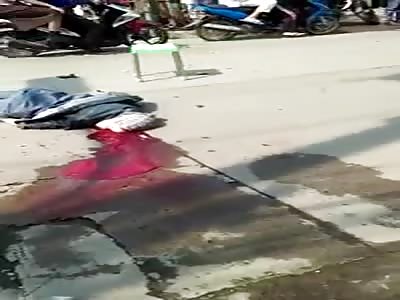 accident, run over, crushed head