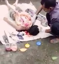 Autopsy on a young man from India