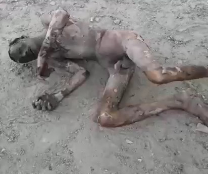 Thief (Still Alive) with the body completely burned after stealing electric mains  