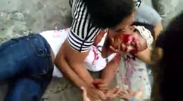 Girl Shot in the Face Still Agonizing on the Sidewalk