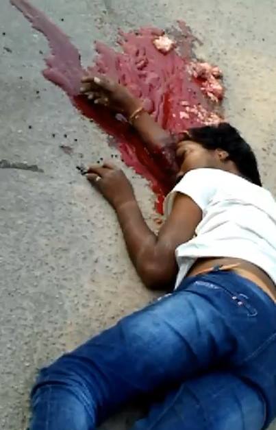 Girl with Open Skull loses his Brain 