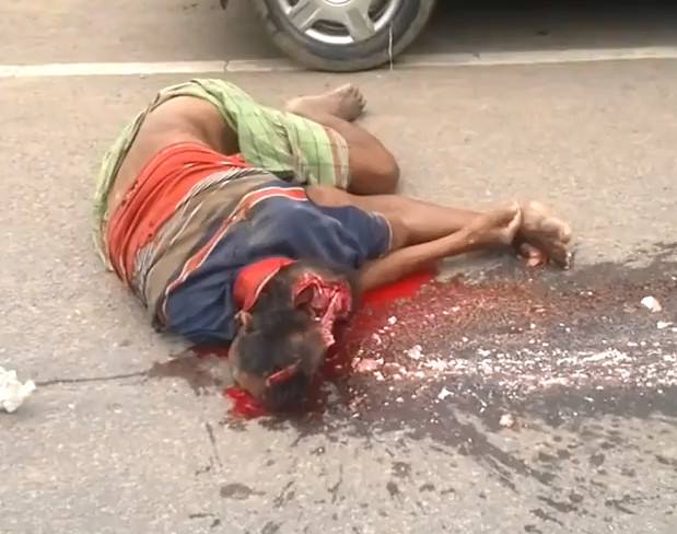 Old Woman with Open Skull loses his Brain 