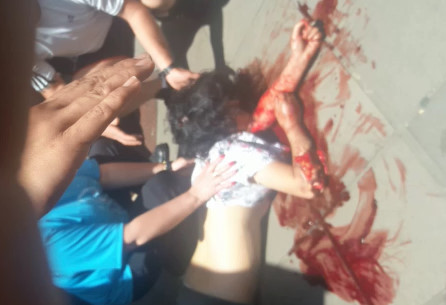 The woman was attacked with a machete by her ex-husband