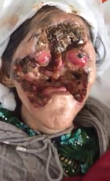 Creepy: Floating Eyeball in Faceless Woman...Still Alive!?