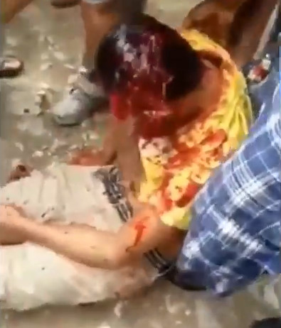 Man Face Hacked with Machete Blows Agonizes