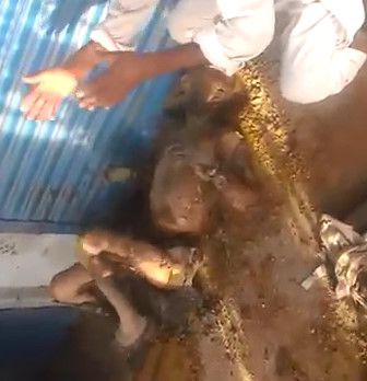 Man Burned Head to Toe is still Somehow Alive