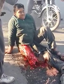 A Dangerous Accident Of a School Boy
