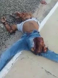 Man Biker has Leg Snapped in Half