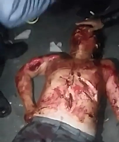 The Man was Savagely Murdered with Axe blows 