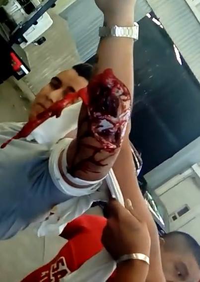 Taxi driver hacked up with machete by resisting being stolen