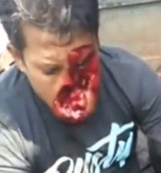 Ready for the Disguises Party After Accident 