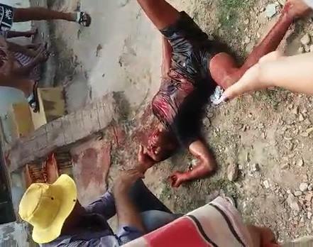 Man Horribly Stabbed in Total Shock on the Street