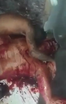 Dude Shot in the Head Takes his Last Dramatic Last Breathe of Air 